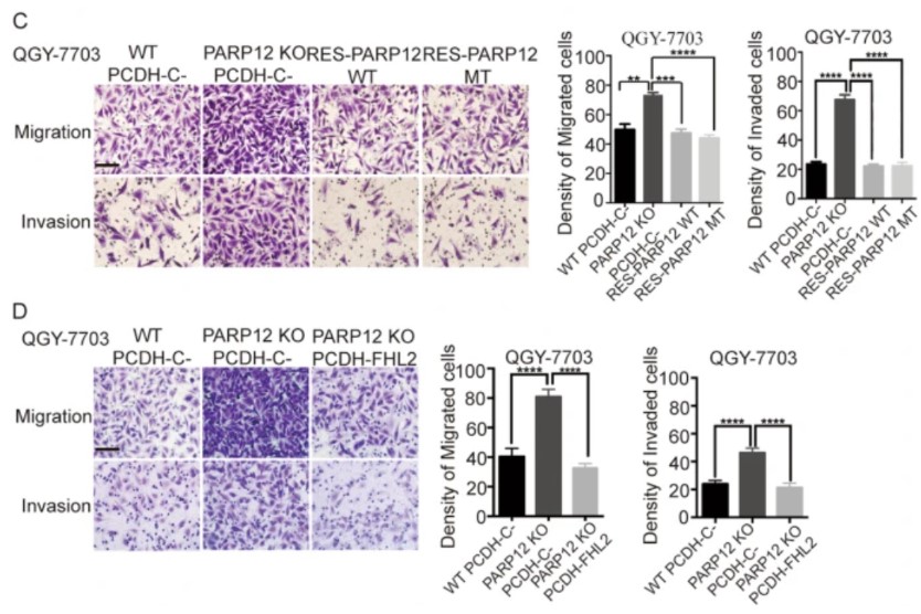 Wild-type and enzyme-inactive mutant PARP12 reconstitutions decreased the migration and invasion.jpg